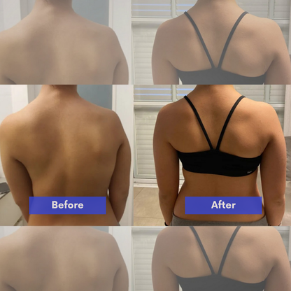 Valesso™ Instant Posture Corrector