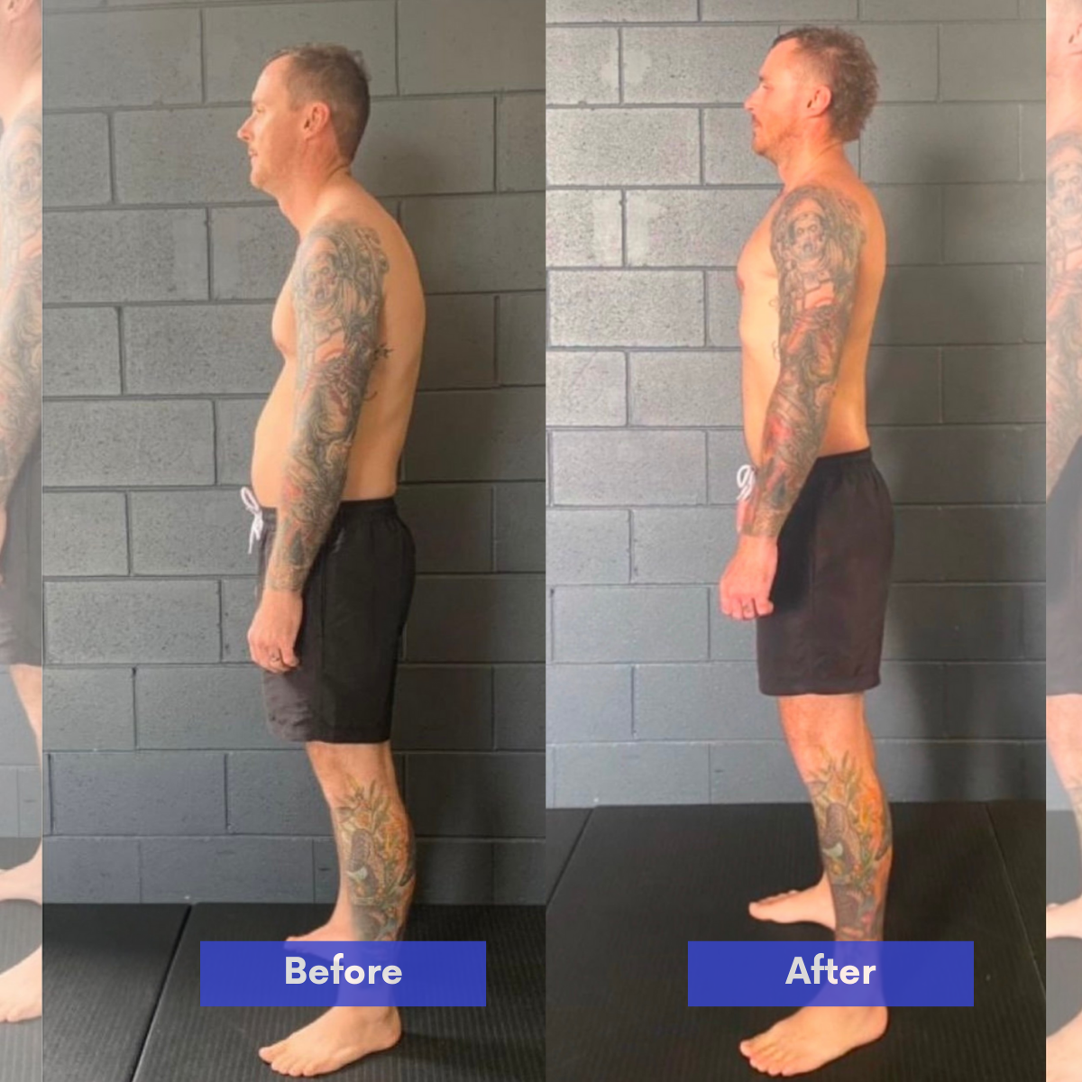 Valesso™ Instant Posture Corrector