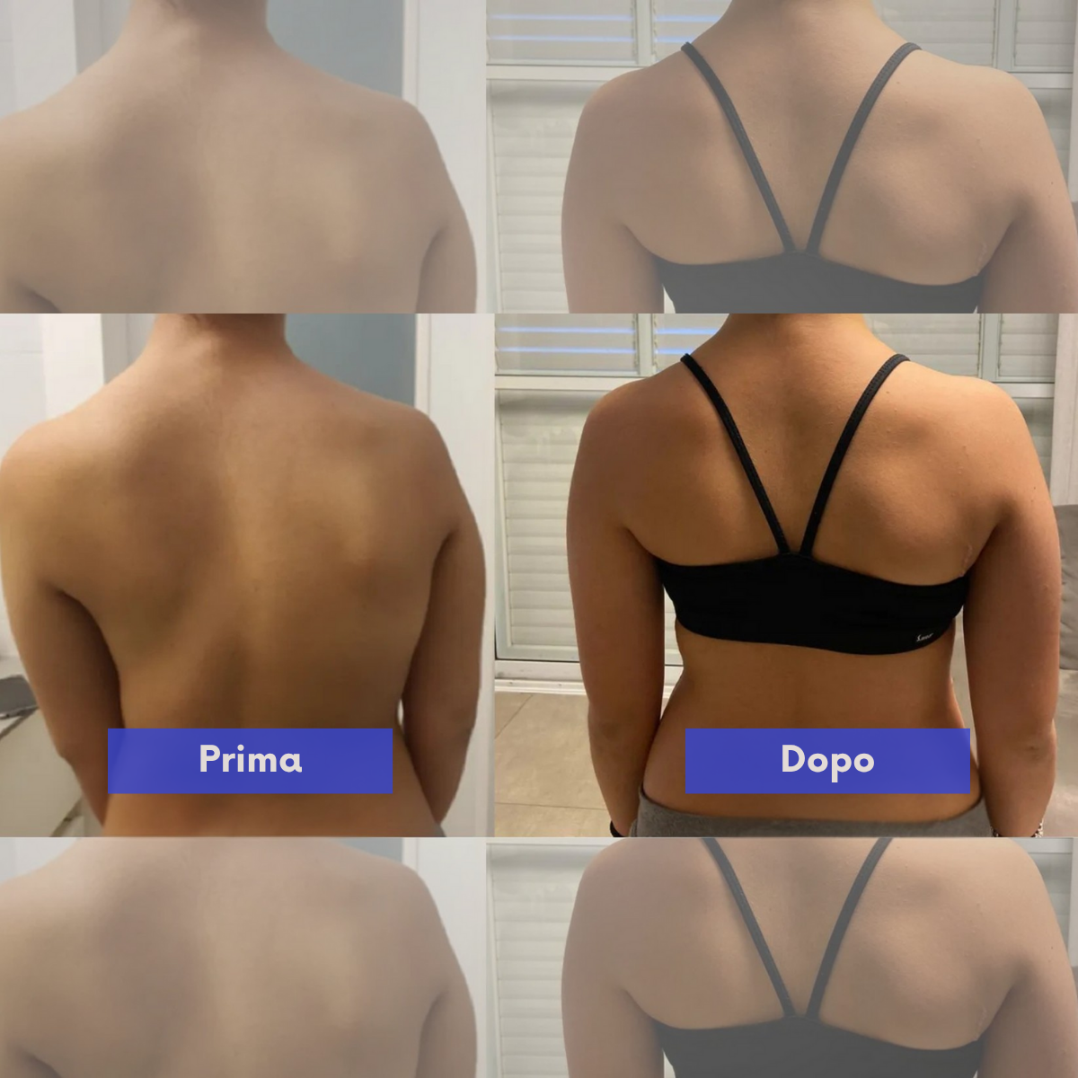 Valesso™ Instant Posture Corrector